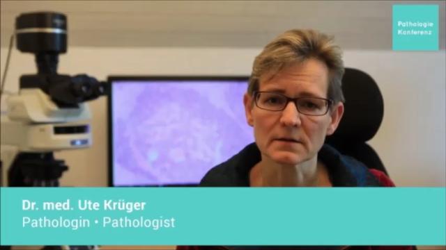 Švedski patolog izvještava o porastu agresivnih karcinoma nastalih nakon mRNA uboda!